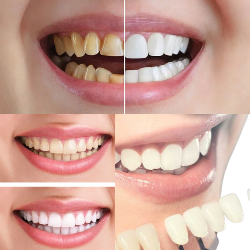 cosmetic dentistry